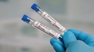 Rio Grande do Sul ultrapassa os 100 mil infectados por coronavírus