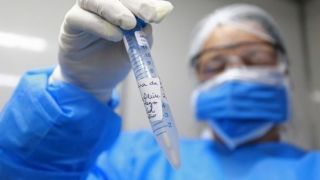 Brasil ultrapassa 112 mil mortes pela Covid-19 e atinge 3,5 milhões de casos