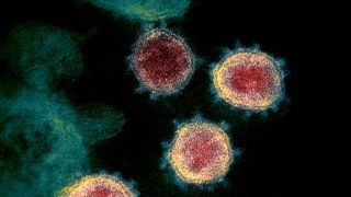 Pacientes na Holanda e na Bélgica foram reinfectados pelo novo coronavírus, diz imprensa
