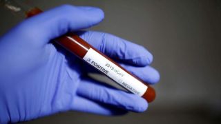 ''Ainda é preciso entender melhor as reinfecções por Covid'', diz diretor da Opas