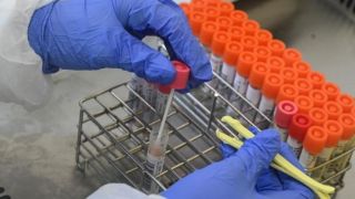 Anvisa pode agilizar aprovação da vacina coronavac no Brasil