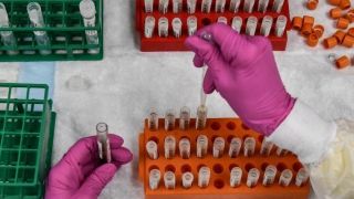 Laboratórios francês e britânico começam a testar em humanos vacina contra a Covid-19