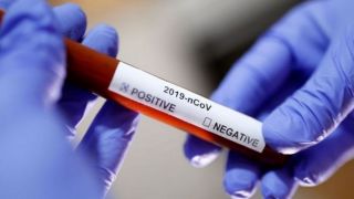 RS tem 15 mortes confirmadas e 641 novos infectados por Covid-19