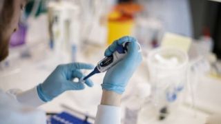 RS passa dos 170 mil casos e chega a 4.318 mortes por coronavírus
