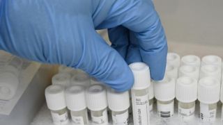 RS registra 33 novos óbitos e total sobe para 6.034 mortes por Covid-19