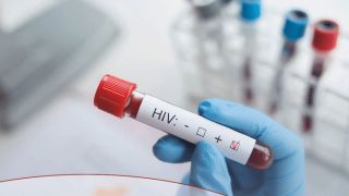 USP busca voluntários para testar vacina contra HIV