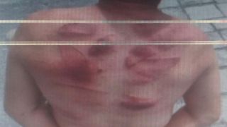Homem é espancado após marcar encontro com criança de 12 anos em Caxias do Sul