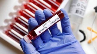 Rio Grande do Sul registra 733 novos casos de Covid-19 e mais 59 mortes provocadas pela doença
