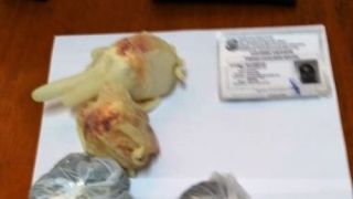 Scanner corporal da Penitenciária de Rio Grande flagra duas visitantes com drogas escondidas em partes íntimas