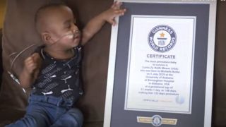 Bebê com apenas 21 semanas de vida entra no Guinness Book como o mais prematuro a sobreviver