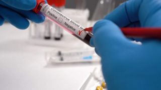 Brasil registra 227 mortes por Covid em 24 horas
