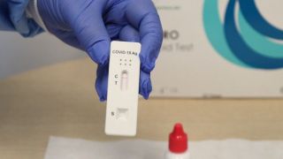 Taxa de positivos para o coronavírus em testes de farmácia salta a 43% no Brasil