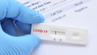 Rio Grande do Sul registra 562 novos casos de Covid-19 e mais uma morte provocada pela doença