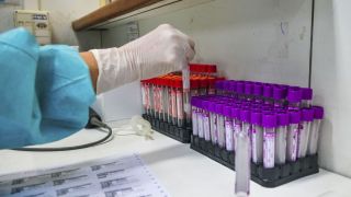 Saúde classifica varíola do macaco como ameaça de excepcional gravidade no Brasil