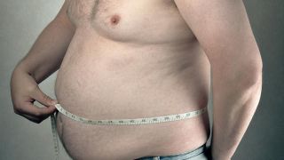 Obesidade ultrapassa fumo como causadora de 4 tipos de câncer