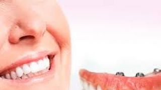 Mais de 200 pessoas foram beneficiadas com prótese dentária em 2018