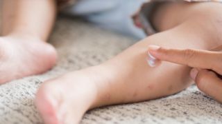 Sem vacina de sarampo para menores de 6 meses, como proteger bebês do contágio da doença?