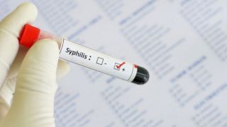 Brasil não consegue parar sífilis, e doença alcança maior índice desde 2010