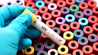 HIV: seis avanços no combate à aids registrados em 2019