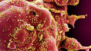 Coronavírus pode infectar intestino, além de pulmões, diz pesquisa