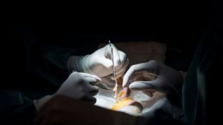 Pessoas infectadas pelo novo coronavírus não podem ter os órgãos doados para transplante
