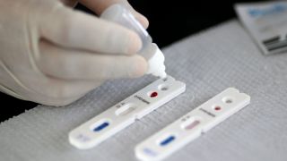 Britânicos que produzem vacina farão testes com 10 mil pessoas