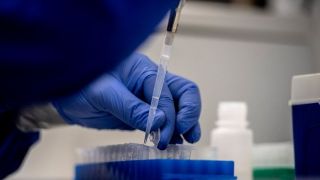 Vital Brazil e UFRJ testam soro para tratar covid-19