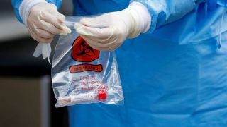 Tipo sanguíneo e genes estão ligados à covid-19 grave, mostra estudo