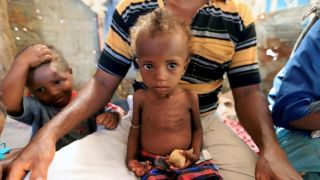 Até 132 milhões podem passar fome em 2020 por causa da pandemia, dizem agências da ONU