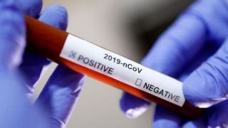 RS tem 1.397 mortes e mais de 53 mil casos confirmados de Covid-19