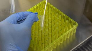 Países com vacina obrigatória para tuberculose têm menos mortes por Covid-19