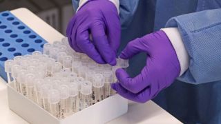 Covid-19:Brasil tem 1,2 mil novas mortes e 60 mil novos casos
